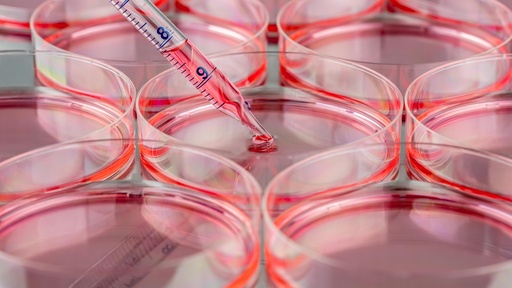 [SK-25CELL-121] Mouse Myeloid Leukemia Lymphocytes